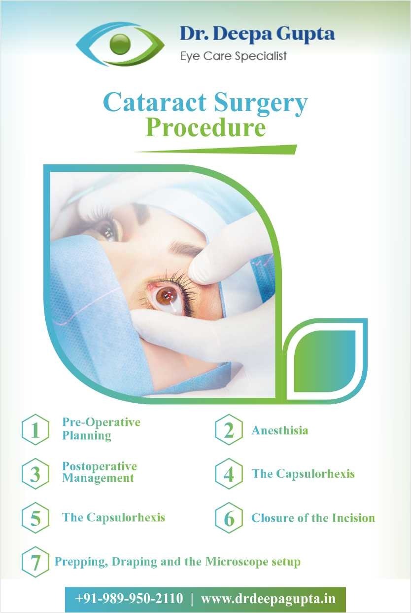 Cataract Surgery Procedure