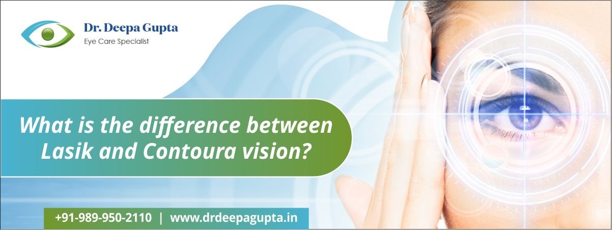 Difference Between LASIK and Contoura Vision