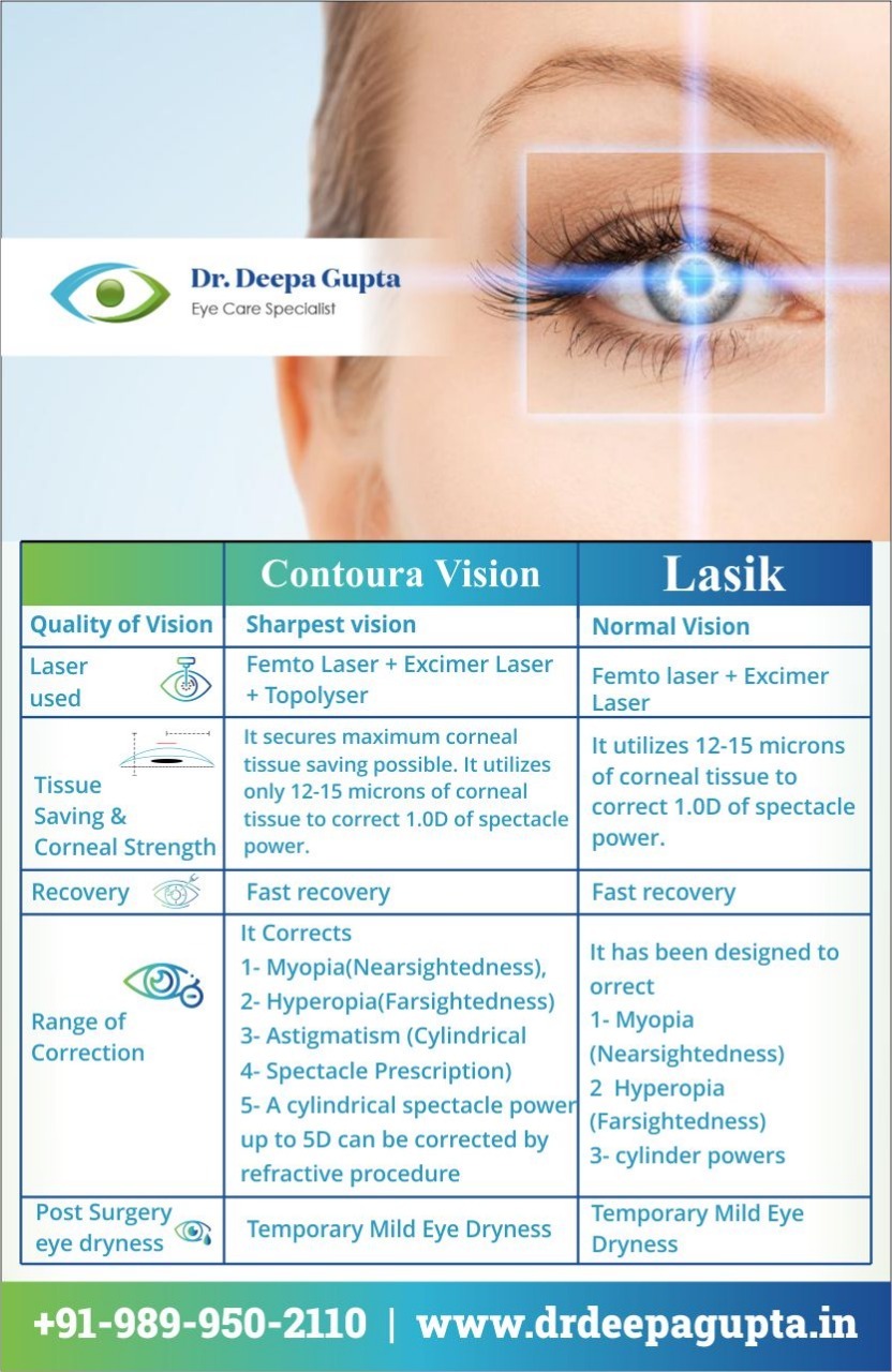 Difference Between LASIK and Contoura Vision
