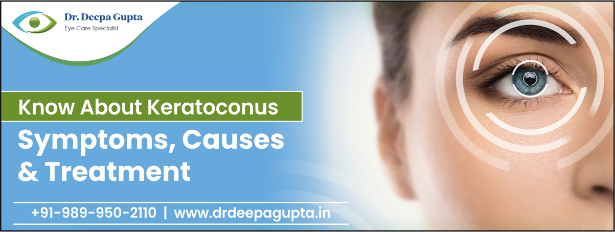 Keratoconus: Signs & Symptoms, Causes and Treatment