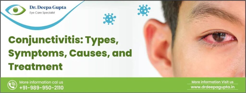 What is Conjunctivitis?