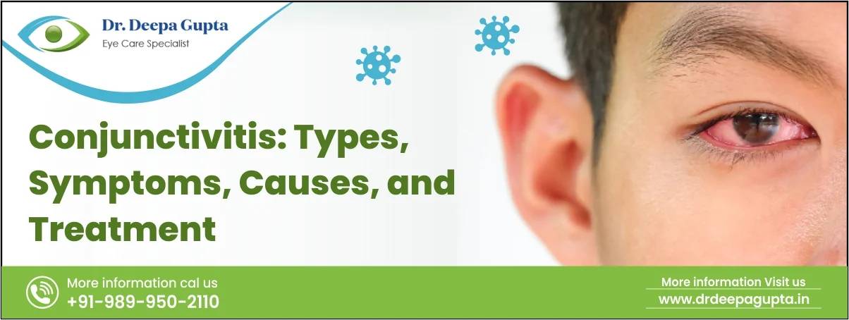 What is Conjunctivitis?