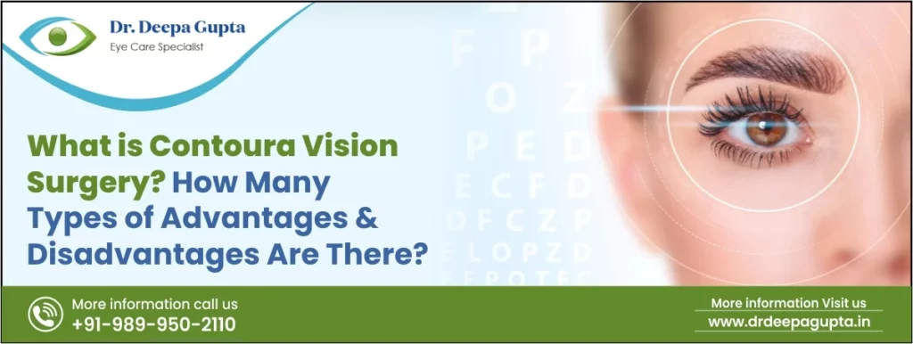 What is Contoura Vision Surgery?