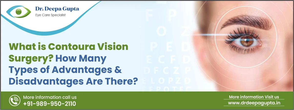 What is Contoura Vision Surgery?
