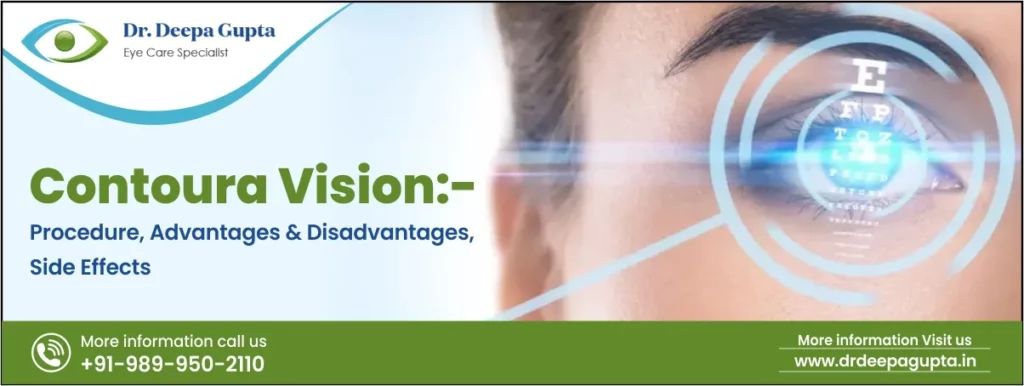 Contoura Vision:- Procedure, Advantages & Disadvantages