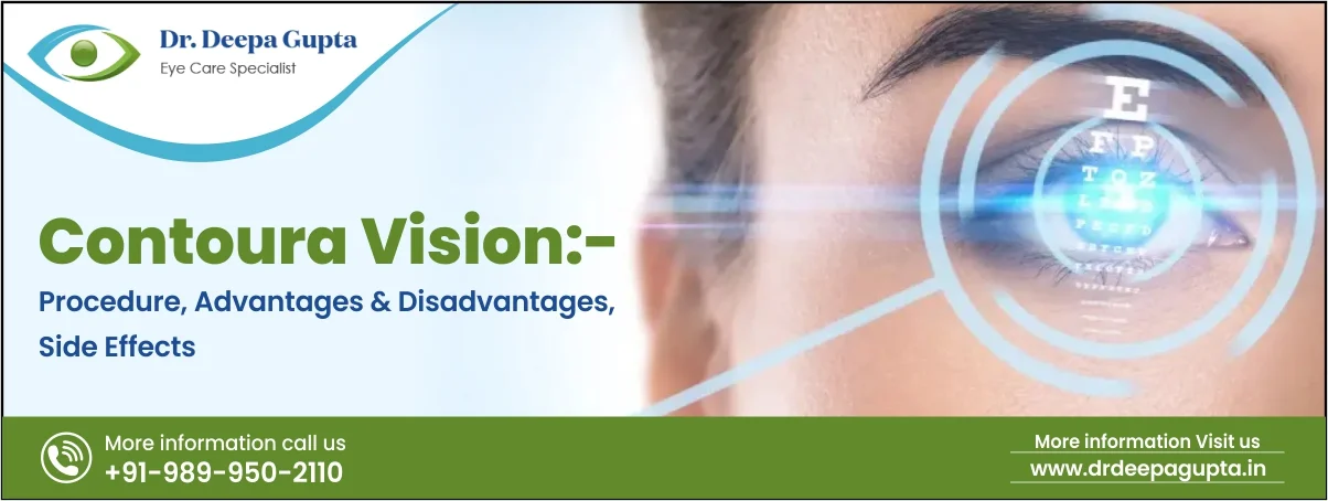 Contoura Vision:- Procedure, Advantages & Disadvantages